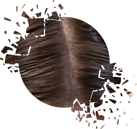 При любом виде перхоти